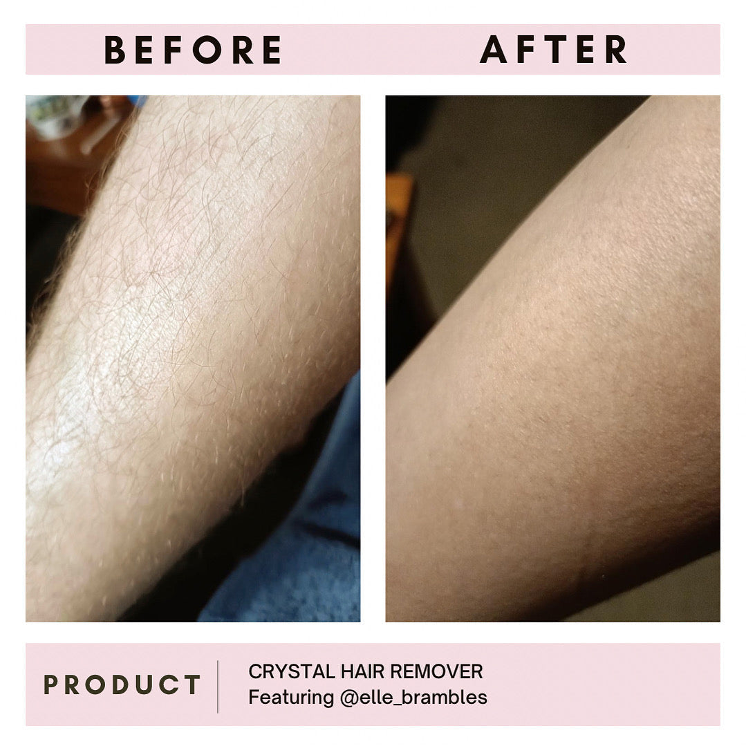 Crystal Hair Remover + Rose Otto Elixir Duo Set