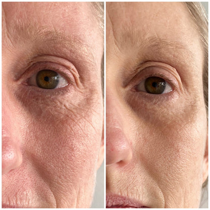 2-In-1 Face And Eye Cream Face Cream Eye Cream Sensitive Skin Sensitive Skin Care Facial Cream 