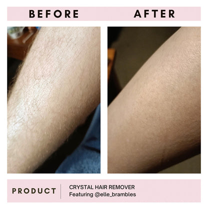 Crystal Hair Remover